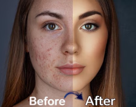Retouching